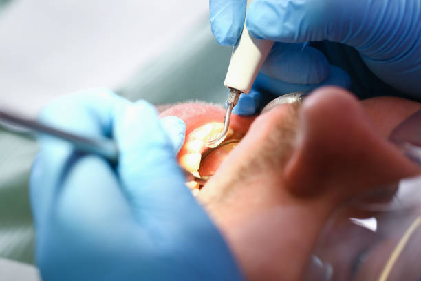 Best Urgent Dental Care for Toothaches in Lexington, MI
