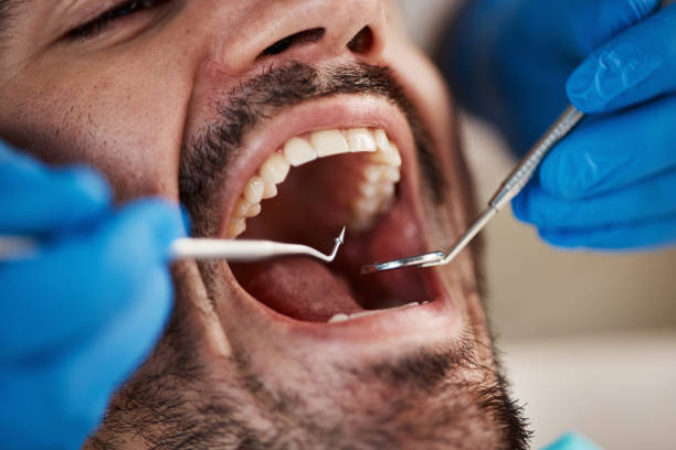 Best Urgent Dental Care for Toothaches in Lexington, MI